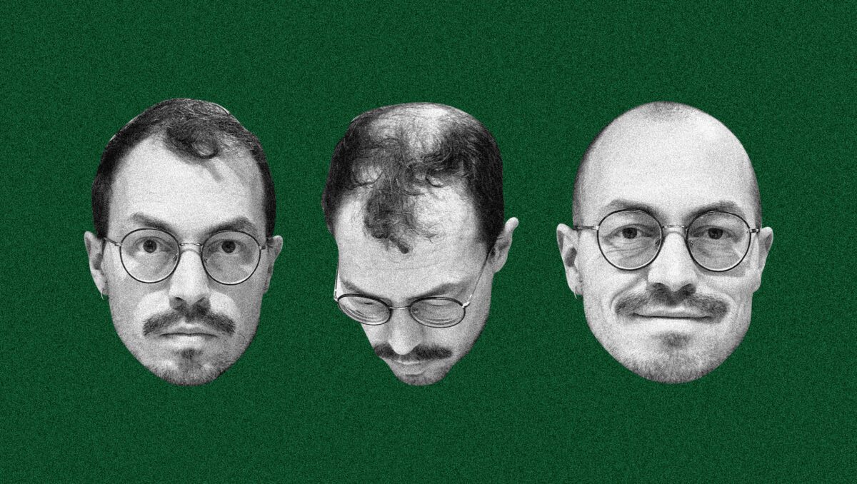 Don’t Go to Turkey, Just Go Bald Instead